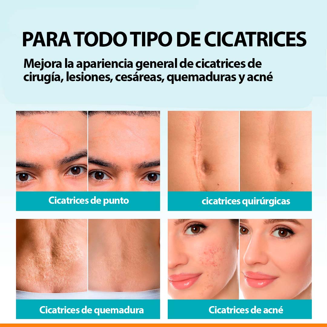 Miniatura 4 de ClearFlaw Timilk - Piel sin cicatrices